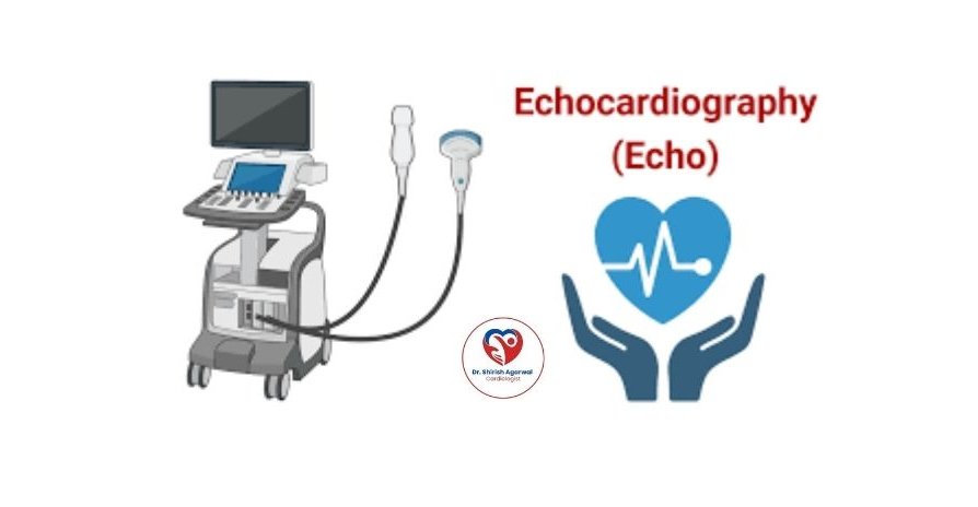 An echocardiography machine illustration alongside a heart graphic with a heartbeat line and hands, labeled "Echocardiography (Echo).