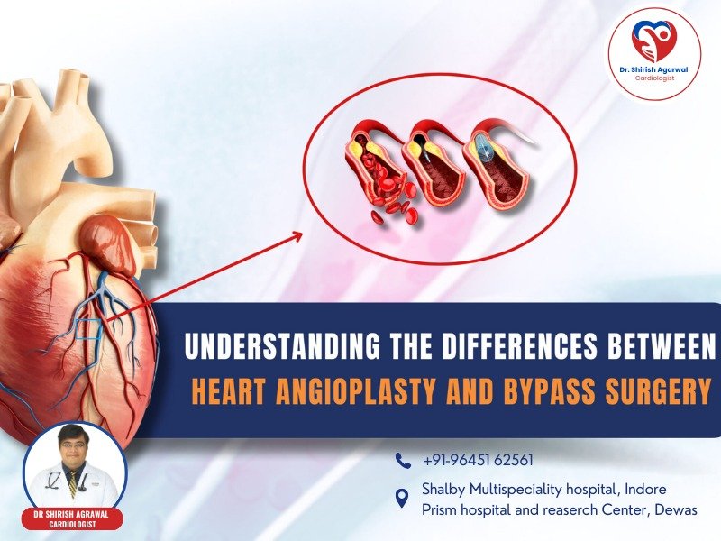 Illustration explaining the differences between heart angioplasty and bypass surgery with a focus on blocked arteries and treatments.