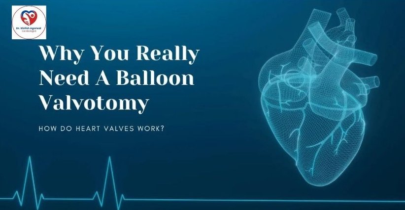 An illustration of the heart with a title discussing the importance of balloon valvotomy.