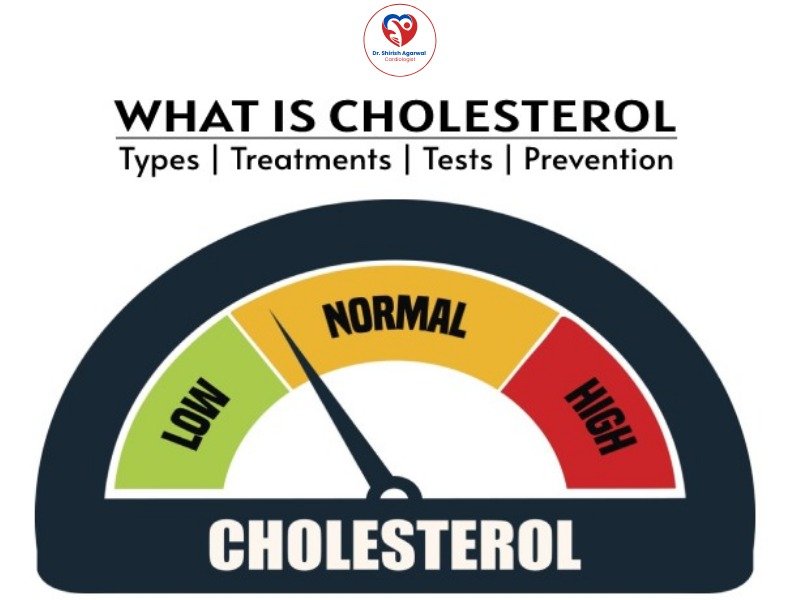 Cholesterol levels meter showing low, normal, and high ranges with information on types, treatments, tests, and prevention.