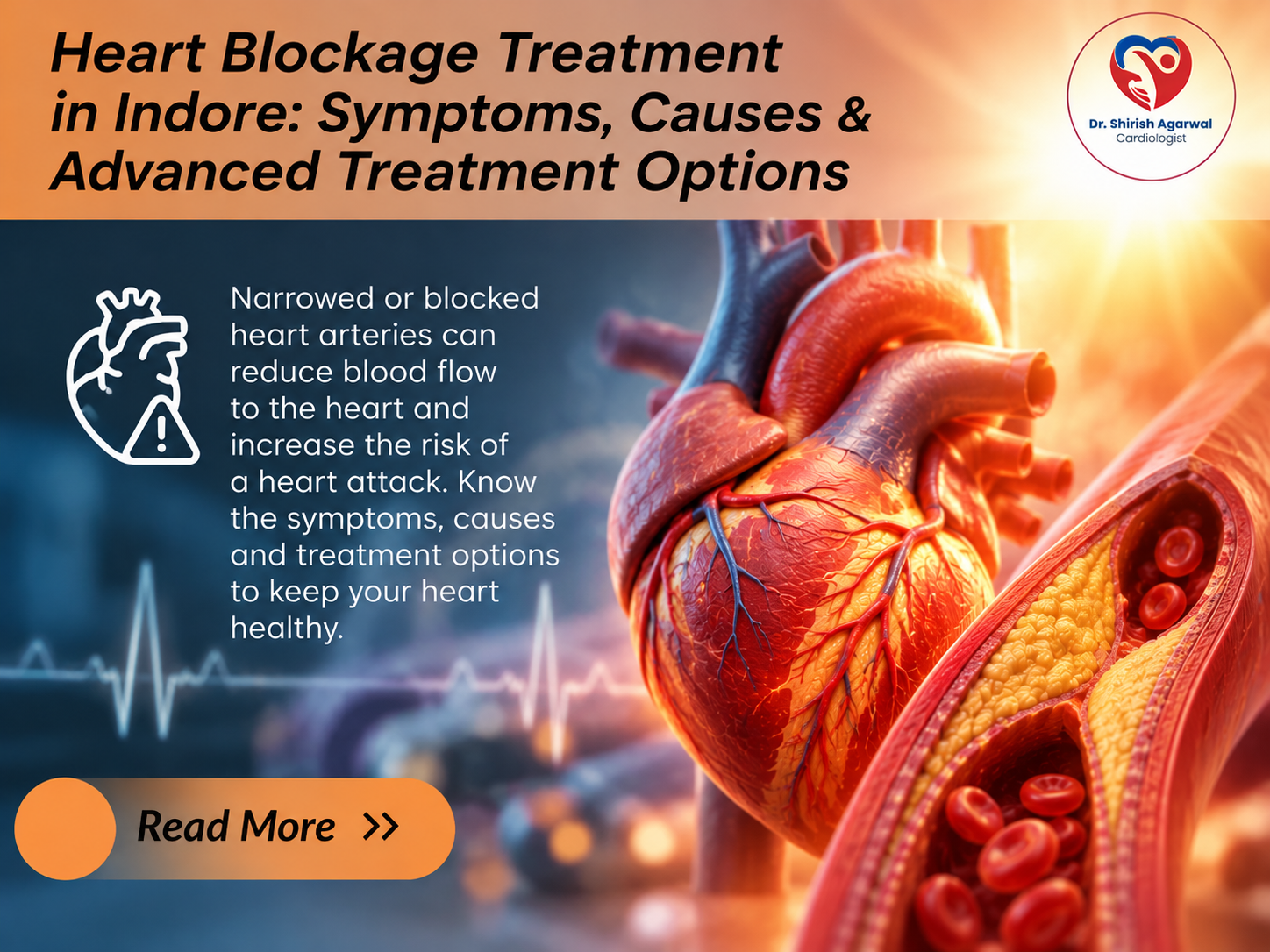 Heart blockage treatment in Indore showing symptoms, causes, advanced treatment options, heart arteries and blocked artery illustration